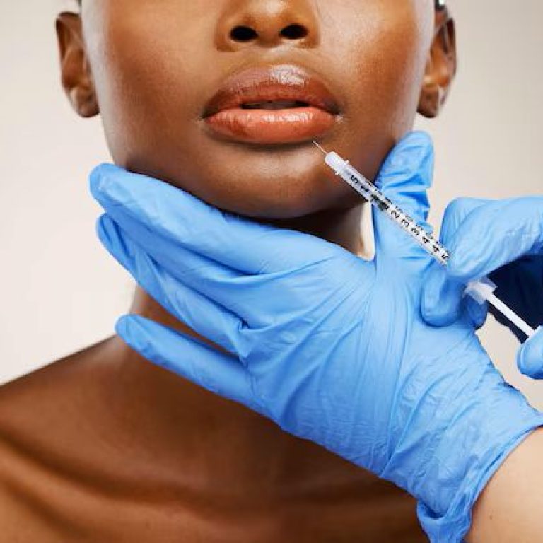 Dermal filler lip treatment being performed using injectable techniques